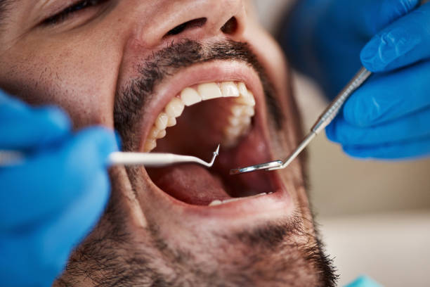 Best Emergency Dental Care for Broken or Chipped Teeth in Springville, UT